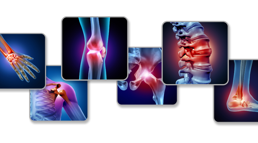 Knowing These Seven Secrets Will Make Your Joint Pain Look Amazing