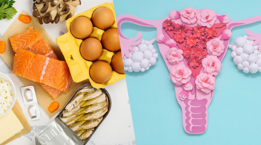 The Role Of Vitamin D in PCOS vitamin D and PCOS