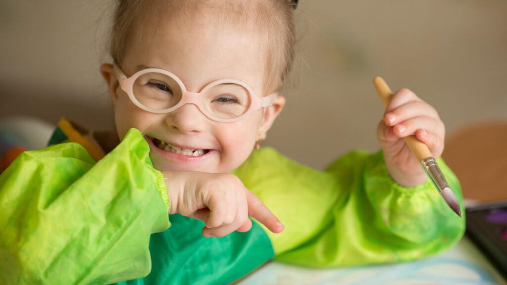 type of Down syndrome
