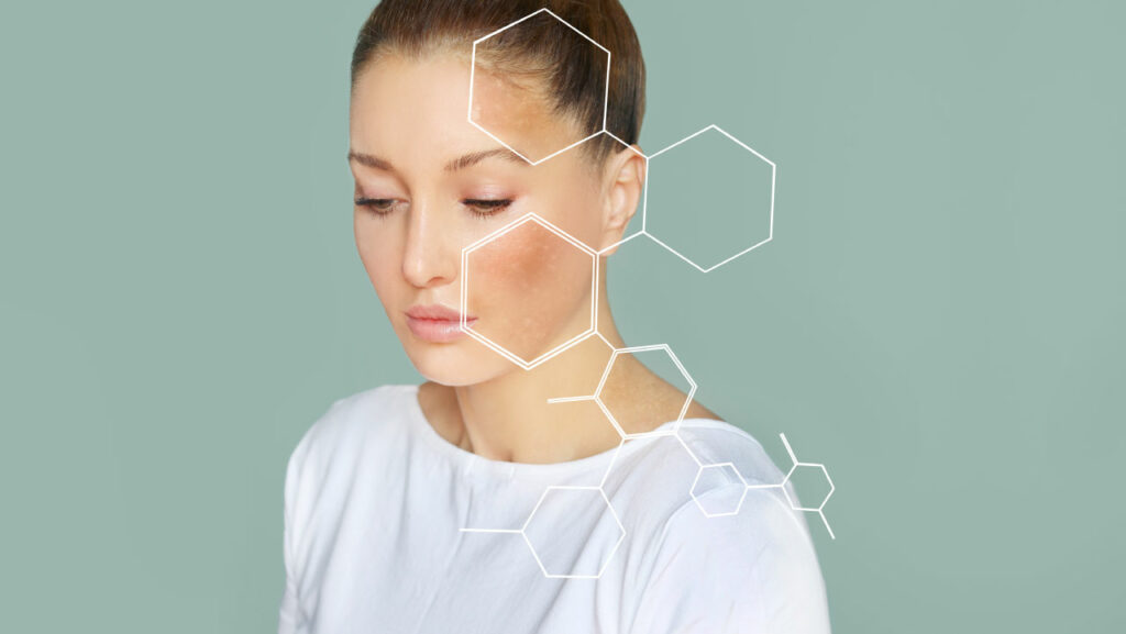 Vitamin K for skin