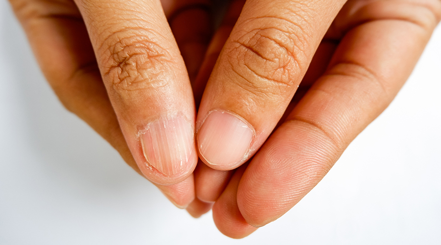 A Mineral Deficiency is More Dangerous Than it Sounds Mineral Deficiency