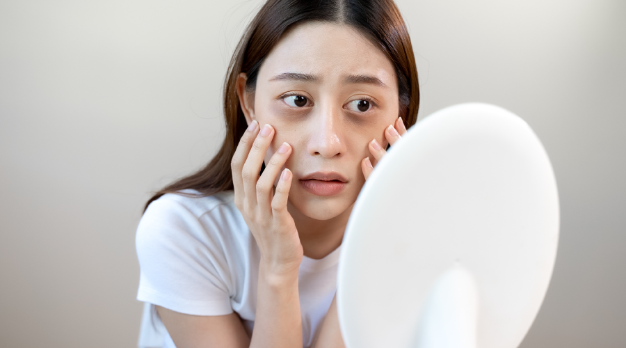 Bags Under Eyes How to Get Rid of Them HealthKart