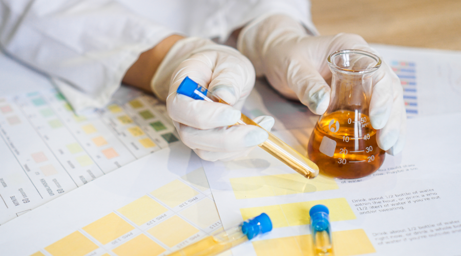 What Your Urine Colour Says About Your Health? Urine Colour