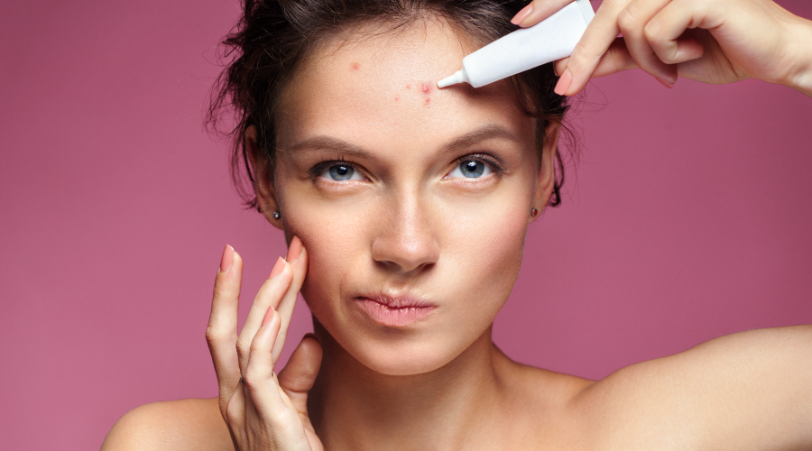 Forehead Acne Everything You Need To Know HealthKart