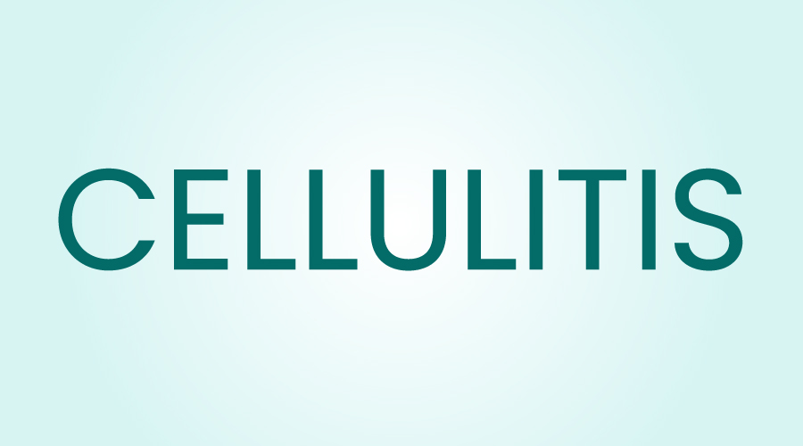 Cellulitis Symptoms, Causes, and Treatment HealthKart