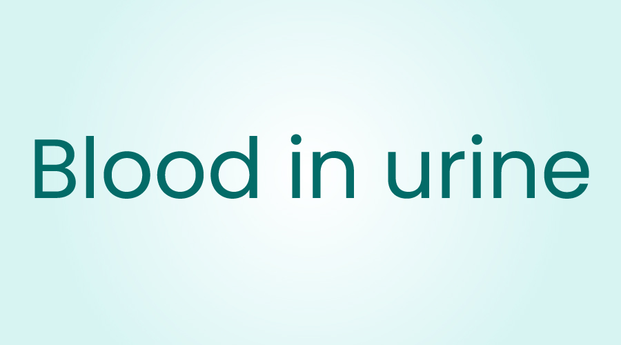 Blood in Urine Causes, Symptoms, and Care HealthKart