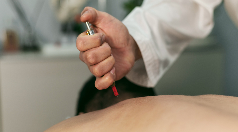 Dry Needling for Muscle Pain Benefits & Treatment HealthKart